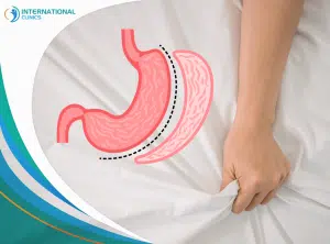 Sex After Gastric Sleeve