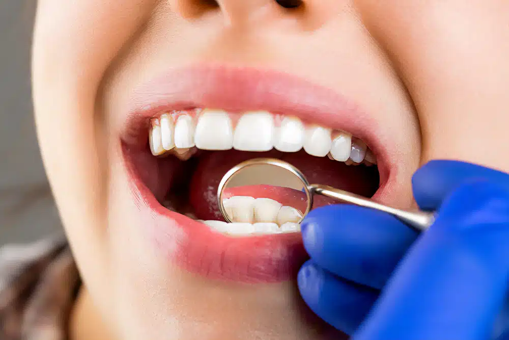 9fd54a0403ae179ab00450dfdb98e187 Dental Implants Cost in Turkey